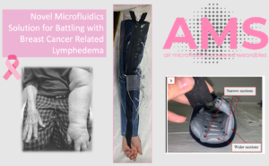 Photo of wearable device and text that reads Novel Microfluidics solution for battling with breast cancer related lymphedema